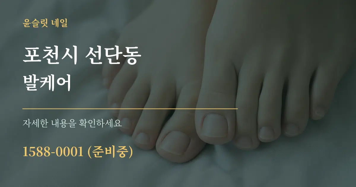 포천시 선단동 발케어 작업 조건 안내 그래픽
