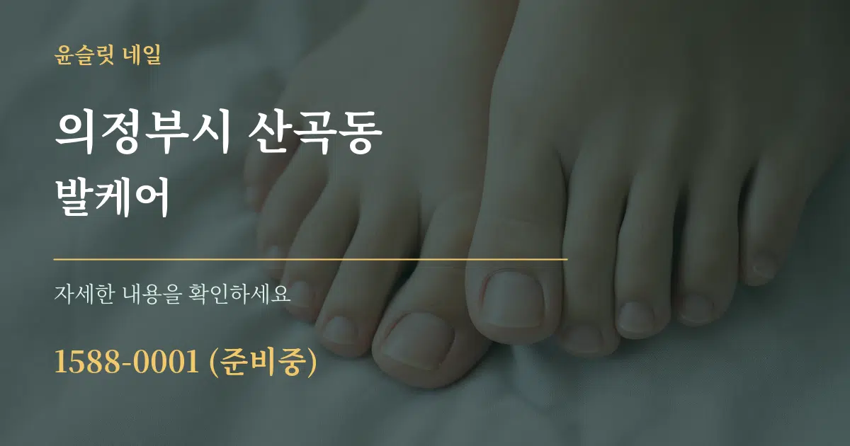 의정부시 산곡동 발케어 작업 조건 안내 그래픽