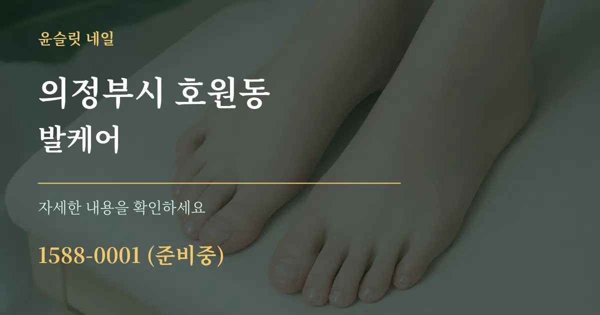 의정부시 호원동 발케어 작업 조건 안내 그래픽